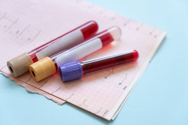 Phlebotomy